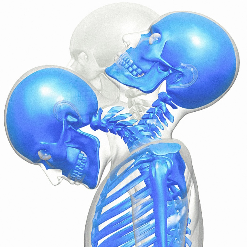 Illustration showing the skull and cervical spine during backward and forward head movement.